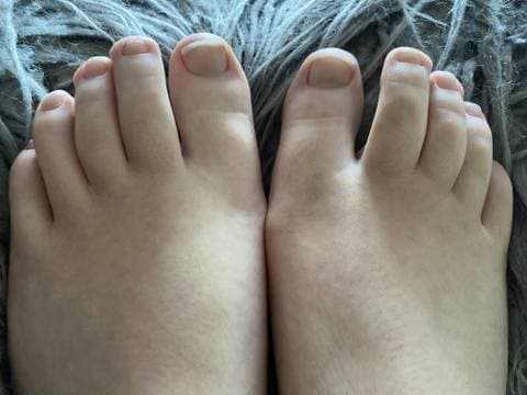 TwinkleToes OnlyFans – free nudes, naked, leaked